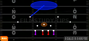 Cover 1 Contain — Man play diagram