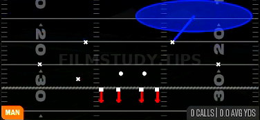 Bracket Switch Willie — Man play diagram